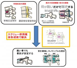 フロー
